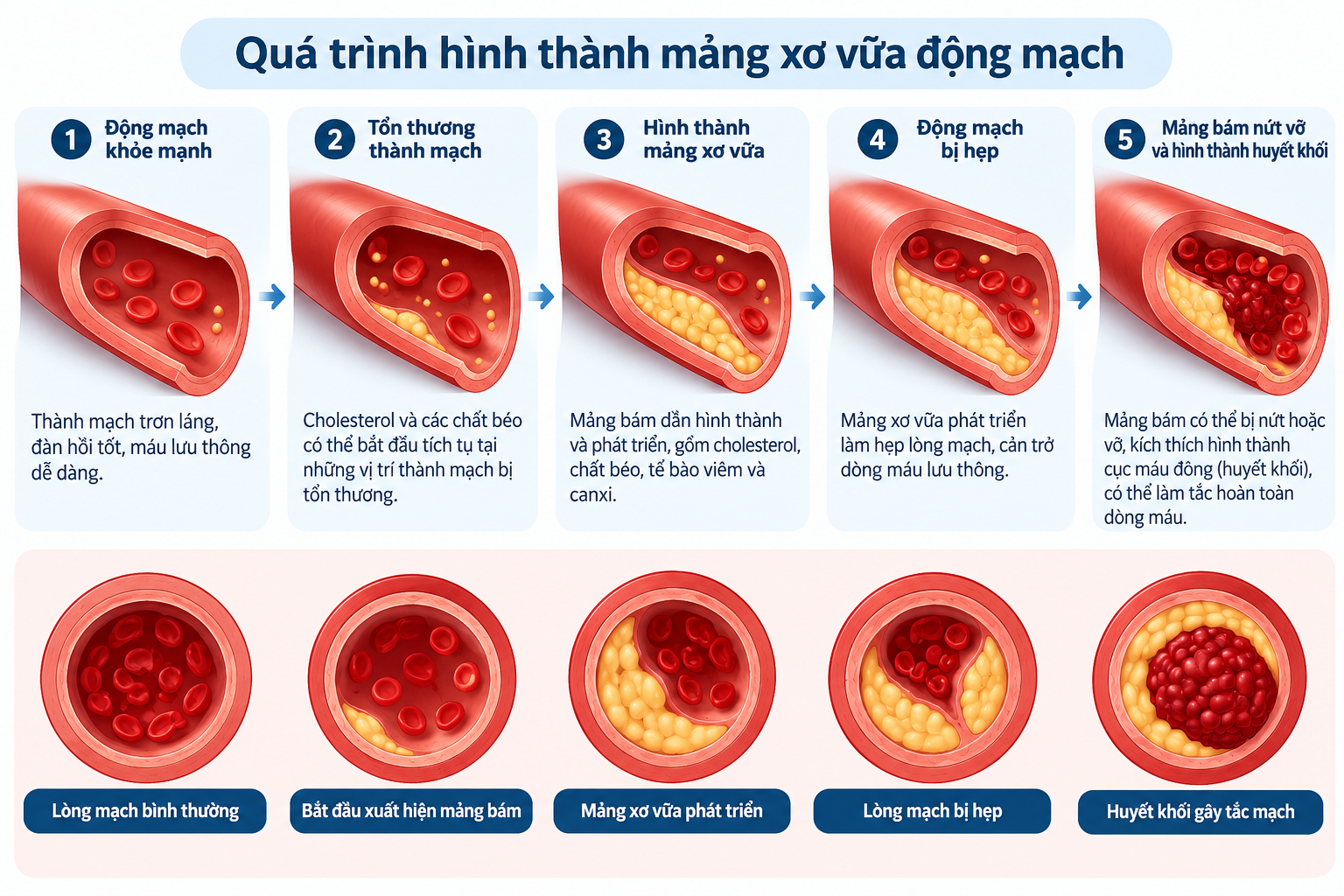 qua-trinh-hinh-thanh-mang-xo-vua.webp